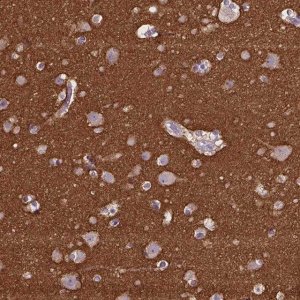 Anti-GNAO1 antibody produced in rabbit 