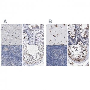 Anti-GOLGA2 antibody produced in rabbit 