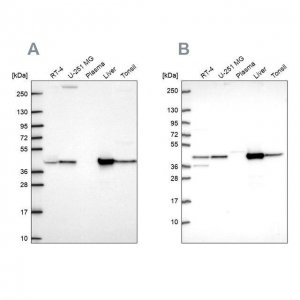 Anti-GOT1 antibody produced in rabbit HPA072629-100UL
