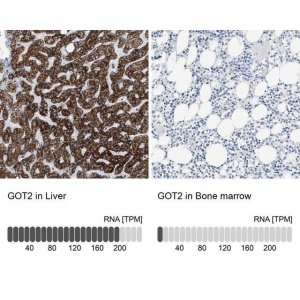 Anti-GOT2 antibody produced in rabbit 