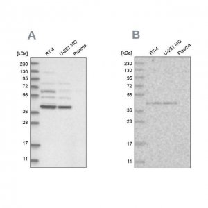 Anti-GPN1 antibody produced in rabbit 