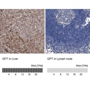 Anti-GPT antibody produced in rabbit 