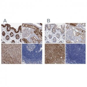 Anti-GPT antibody produced in rabbit 