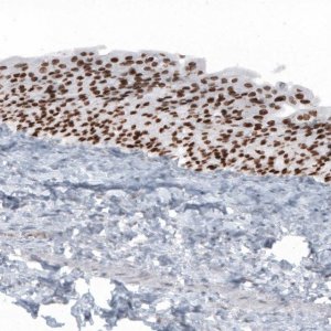 Anti-GRHL2 antibody produced in rabbit 