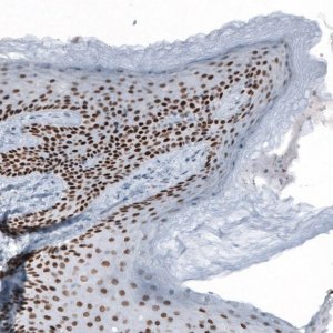 Anti-GRHL2 antibody produced in rabbit 