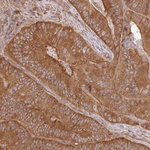 Anti-GSPT1 antibody produced in rabbit 