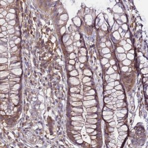 Anti-GSPT2 antibody produced in rabbit 