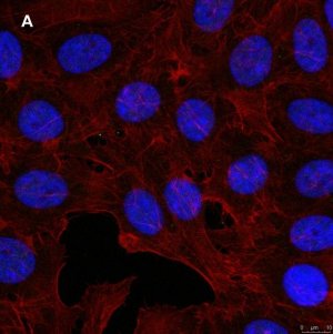 Anti-GST Antibody, clone 5B8 , ZooMAb� Rabbit Monoclonal 