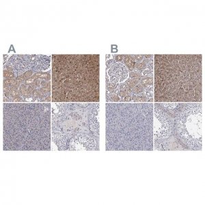 Anti-GSTO1 antibody produced in rabbit 