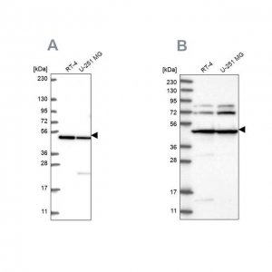 Anti-HADHB antibody produced in rabbit 