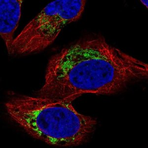 Anti-HADHB antibody produced in rabbit 