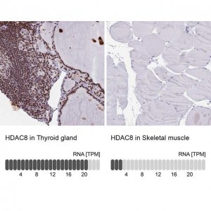 Anti-HDAC8 antibody produced in rabbit 
