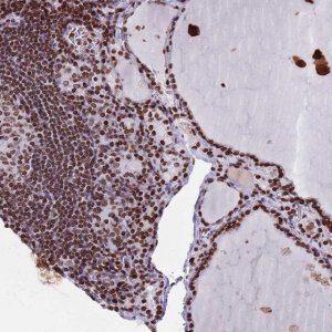 Anti-HDAC8 antibody produced in rabbit 
