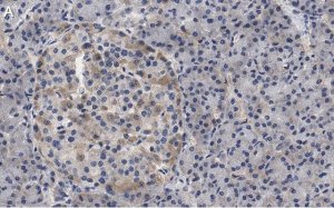 Anti-Helicase MOV-10 Antibody, clone 3B8 ZooMAb� Rabbit Monoclonal 