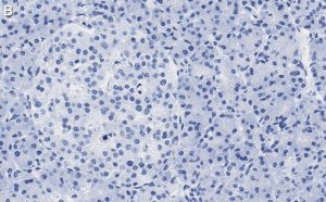 Anti-Helicase MOV-10 Antibody, clone 3B8 ZooMAb� Rabbit Monoclonal 