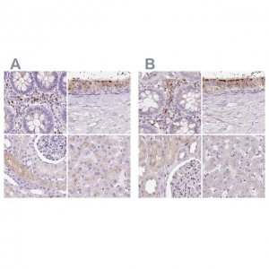 Anti-HEXB antibody produced in rabbit 