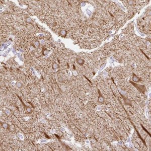 Anti-HEY1 antibody produced in rabbit 