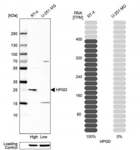 Anti-HPGD antibody produced in rabbit 