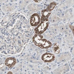 Anti-HPRT1 antibody produced in rabbit 