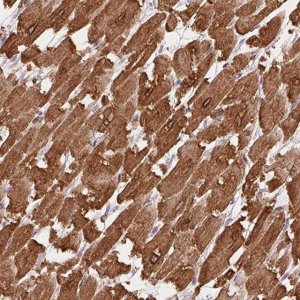 Anti-HRC antibody produced in rabbit 