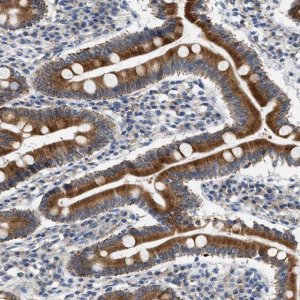 Anti-HSD17B11 antibody produced in rabbit 