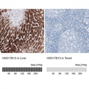 Anti-HSD17B13 antibody produced in rabbit 