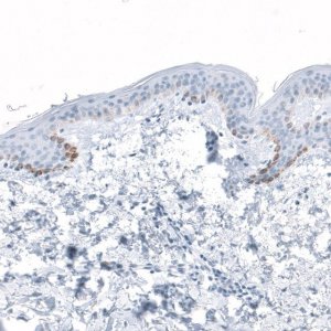 Anti-HSD17B13 antibody produced in rabbit 