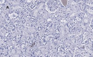 Anti-HSP60 Antibody, clone 1N3, ZooMAb� Rabbit Monoclonal 