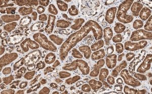 Anti-HSP60 Antibody, clone 1N3, ZooMAb� Rabbit Monoclonal 