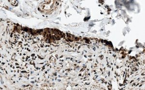 Anti-HSP70 Antibody, clone 4E12 ZooMAb� Rabbit Monoclonal 