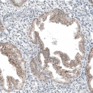 Anti-HTR1E antibody produced in rabbit 