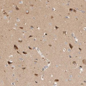 Anti-HTT antibody produced in rabbit 