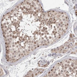 Anti-HUS1 antibody produced in rabbit HPA026787-100UL