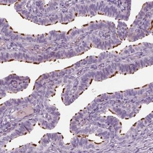 Anti-HYDIN antibody produced in rabbit 