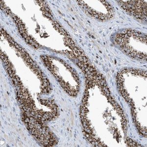 Anti-IBA57 antibody produced in rabbit HPA030557-100UL