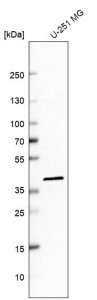 Anti-IDH3A antibody produced in rabbit 