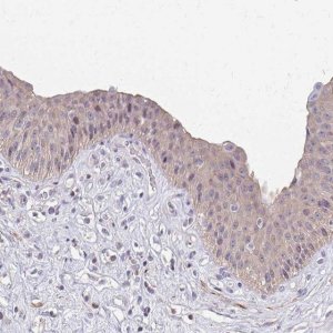 Anti-IFI44L antibody produced in rabbit HPA060372-100UL