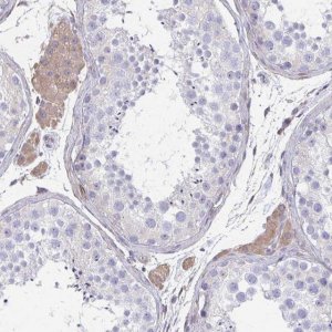 Anti-IFI44L antibody produced in rabbit HPA060372-100UL