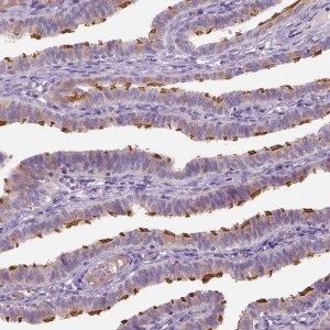 Anti-IFT52 antibody produced in rabbit 