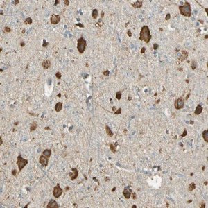 Anti-IGDCC4 antibody produced in rabbit 