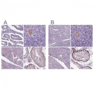 Anti-IGF2BP1 antibody produced in rabbit 