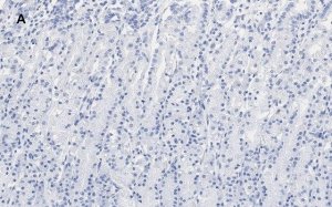 Anti-IKB Antibody, clone 6O8, ZooMAb� Rabbit Monoclonal 