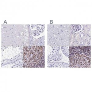 Anti-IKZF1 antibody produced in rabbit 