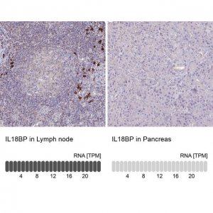 Anti-IL18BP antibody produced in rabbit 