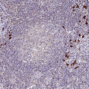 Anti-IL18BP antibody produced in rabbit 