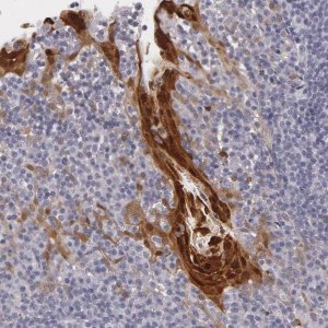 Anti-IL1RN antibody produced in rabbit 