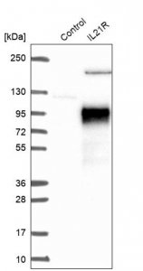 Anti-IL21R antibody produced in rabbit 