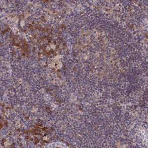 Anti-IL21R antibody produced in rabbit 