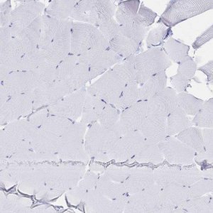 Anti-IL2RB antibody produced in rabbit 