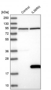 Anti-IL36RN antibody produced in rabbit 
